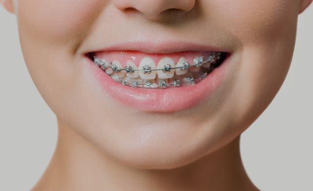 Treatment - DNTL Smiles & Wellness