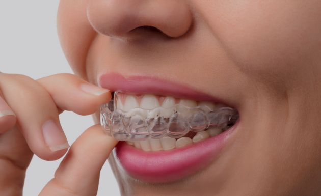 Treatment - DNTL Smiles & Wellness