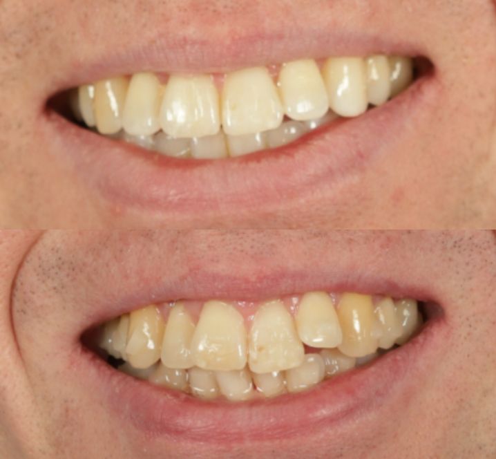 Images by Alexandra Dental