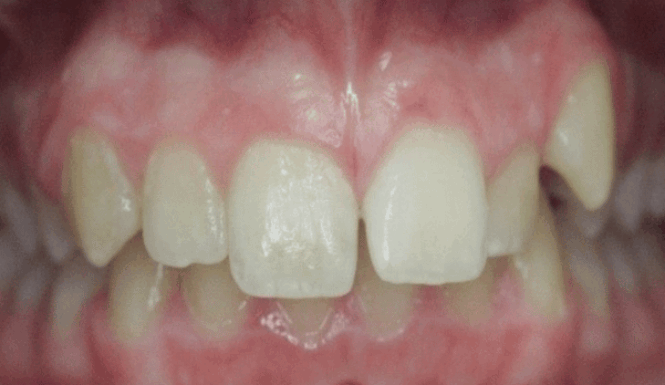 Before - DNTL Smiles