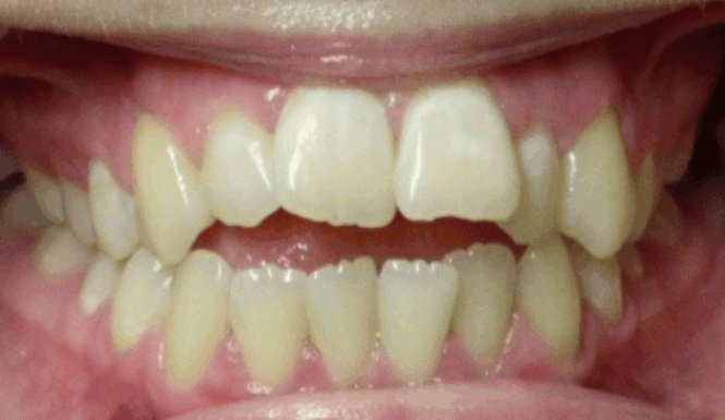 Before - DNTL Smiles