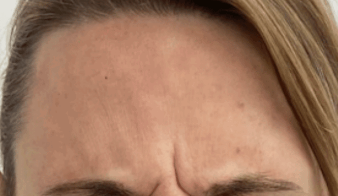 Before - DNTL Smiles