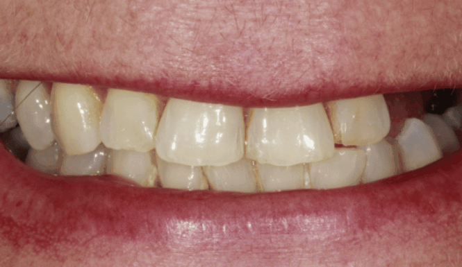 Before - DNTL Smiles