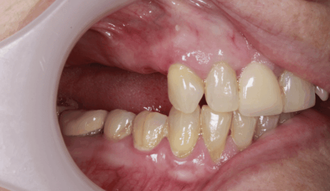 Before - DNTL Smiles