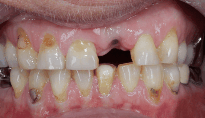 Before - DNTL Smiles