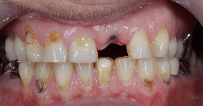 Before - DNTL Smiles & Wellness