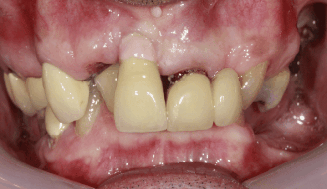 Before - DNTL Smiles