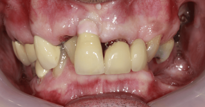 Before - DNTL Smiles & Wellness