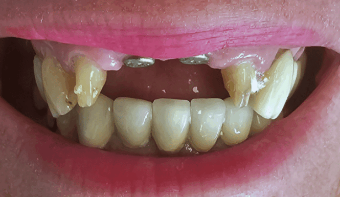 Before - DNTL Smiles & Wellness