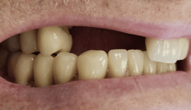 Before - DNTL Smiles & Wellness