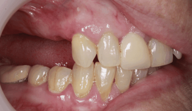 Before - DNTL Smiles & Wellness